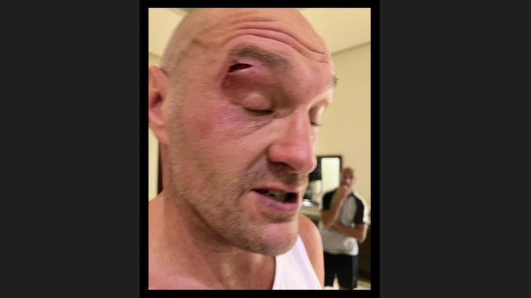 Breaking: Fury vs. Usyk postponed!